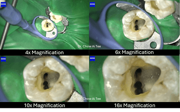 Dental microscope root canal Johor