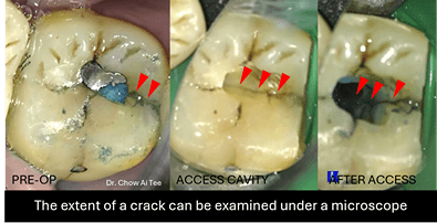 Root canal specialist Johor
