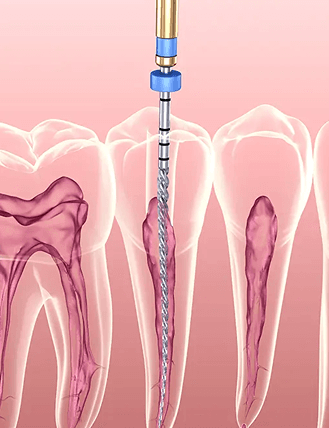 Endodontics