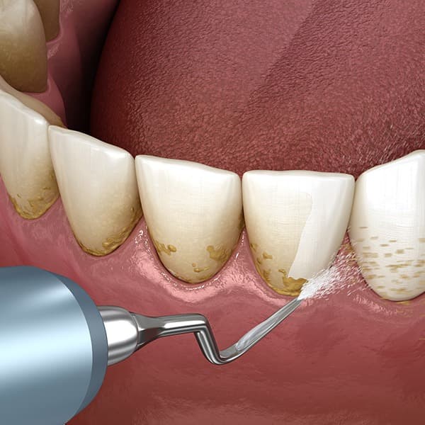 Periodontics