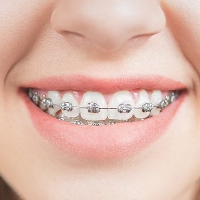 Orthodontics